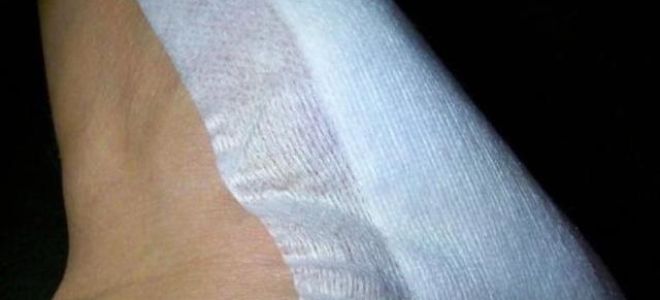 Как вывести шипицу на ноге в домашних условиях?