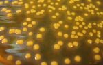 Золотистый стафилококк в кале: причины, симптомы, способы лечения