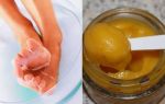 Уксус и яйцо от грибка ногтей — народный рецепт!
