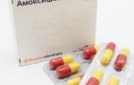 Антибиотики при мононуклеозе: нужны ли и какой лучше