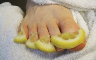 Утолщение ногтей на ногах — причины и лечение