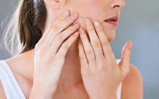 Стафилококк на лице: формы заболевания и их лечение