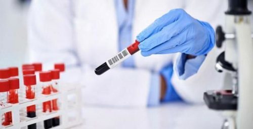 Цитомегаловирус: норма в крови и другие аспекты диагностики