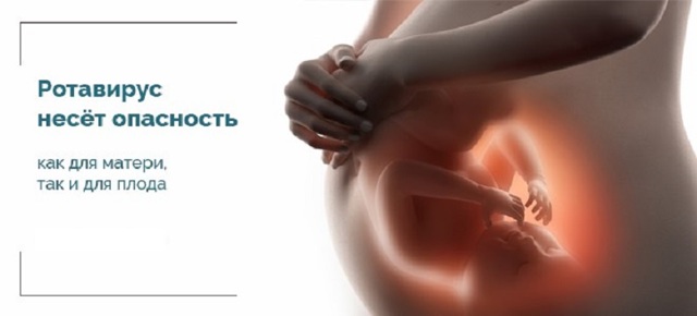 Ротавирус при беременности: как не спутать с токсикозом