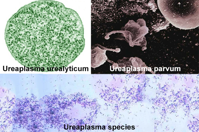 Инфекция уреаплазма: виды, причины распространения и лечение