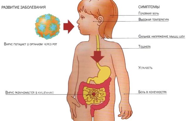 Как передается кишечная инфекция: основные пути распространения