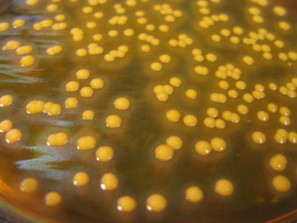 Золотистый стафилококк в кале: причины, симптомы, способы лечения