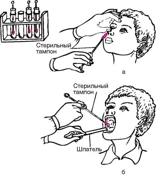 Мазок на стафилококк из зева и носа: показания и подготовка к анализу