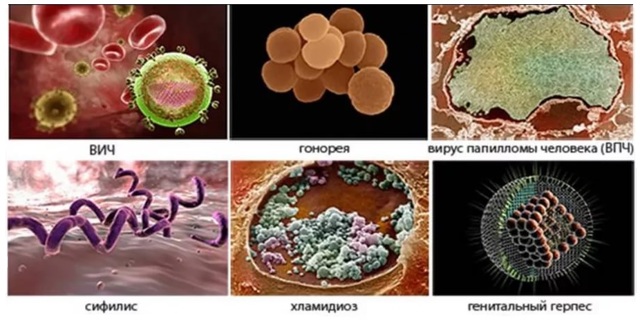 Список ИППП инфекций: их особенности и характеристика