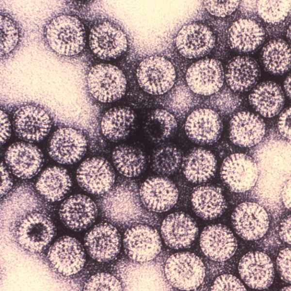 Ротавирусная инфекция: симптомы у взрослых и лечение, особенности