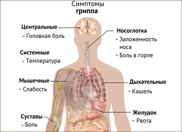 Стрептококк и пневмония: симптомы, лечение, профилактика