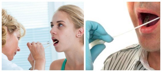 Стрептококк в горле: лечение различных форм инфекции