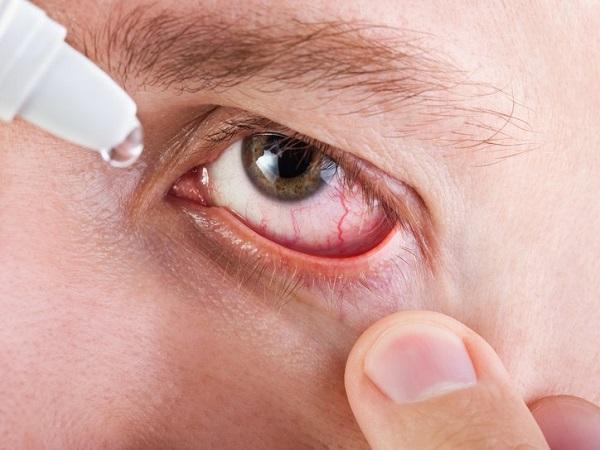 Стафилококк в глазах: причины, симптоматика, лечение