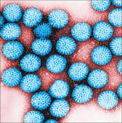 Кишечная ротавирусная инфекция: путь передачи, лечение и профилактика