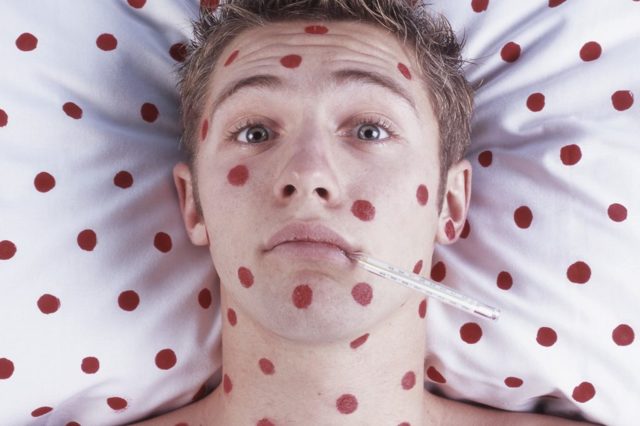 Цитомегаловирус у мужчин: симптомы, лечение и профилактика