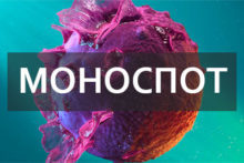 Инфекционный мононуклеоз: диагностика на современном этапе