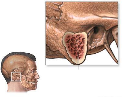 Стрептококки в мазке у мужчин: причины появления, варианты лечения