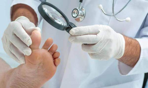Какой врач лечит грибок ногтей на ногах - к кому обратиться?