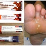 Тербинафин: мазь от грибка ногтей - отзывы, цена инструкция по применению