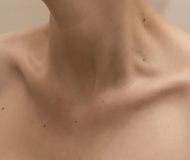 Папилломы на шее: причины появления и лечение