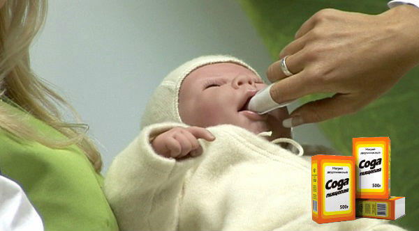 Молочница на языке у новорожденных - как и чем лечить?