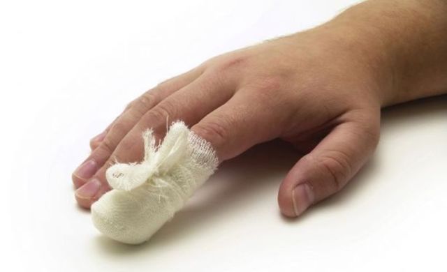 Фундизол: отзывы при лечении грибка ногтей на ногах, цена