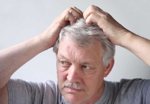 Бородавки на голове и в волосах - причины появления и методики удаления