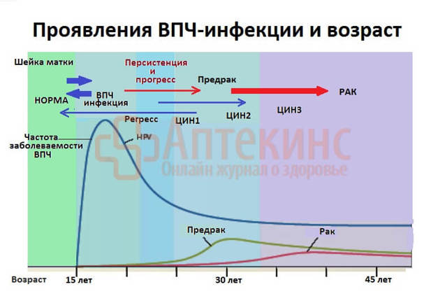 Впч 16 и 18 типа - что это значит и как его лечить?