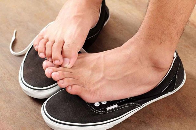 Грибок на ногах - как выглядит и чем лечить в домашних условиях