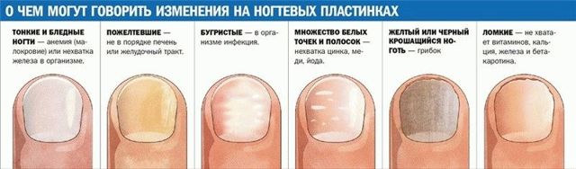 Желтые ногти на ногах - причины и лечение