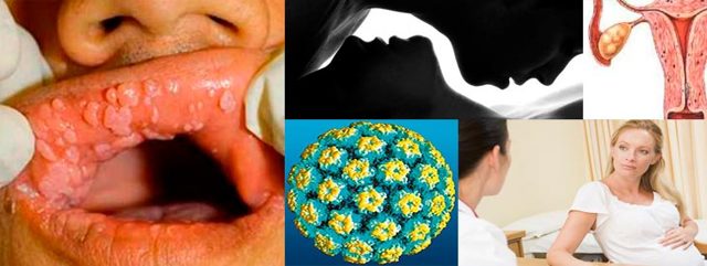 Чем опасен вирус папилломы человека? Самые опасные типы