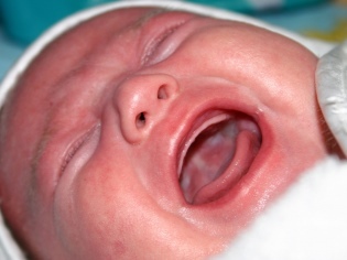 Молочница у ребенка во рту - откуда берется и как её лечить?