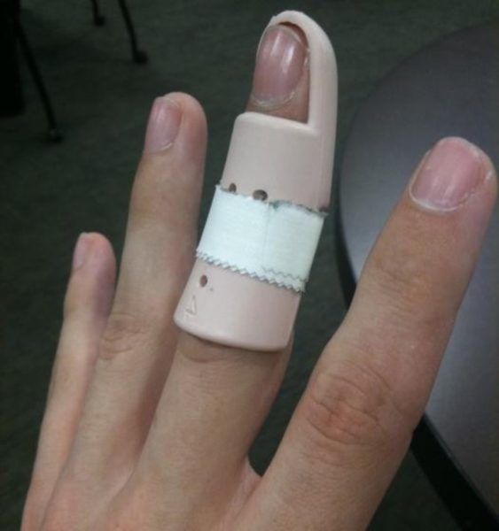 Как удалить шипицу на пальце?