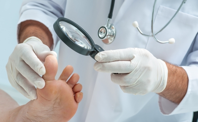 Какой врач лечит грибок ногтей на ногах - к кому обратиться?
